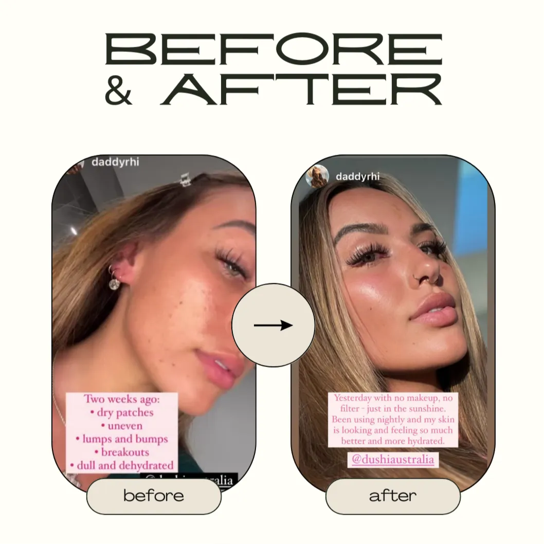 Hyaluronic Acid Serum 10% with Hymagic™ 4D