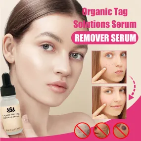 Organic Tags Solutions Serum No Trace Painle Skin Tag Remover Serum Mole Removal Cream Painless Face Wart Mole Freckle