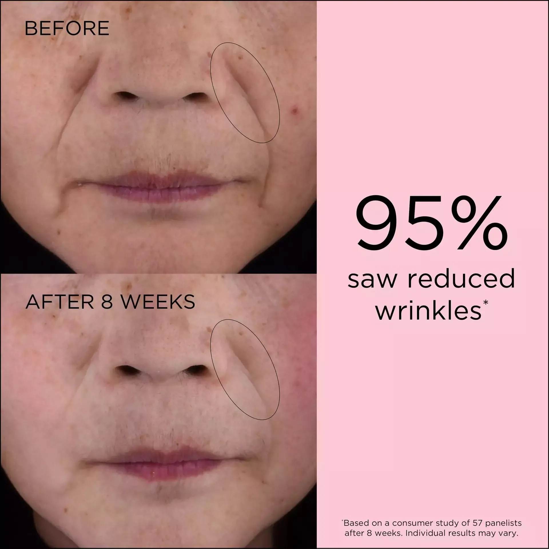 Retinol   HPR Ceramide Capsules Rapid Skin Renewing Serum Set - 180 Pieces